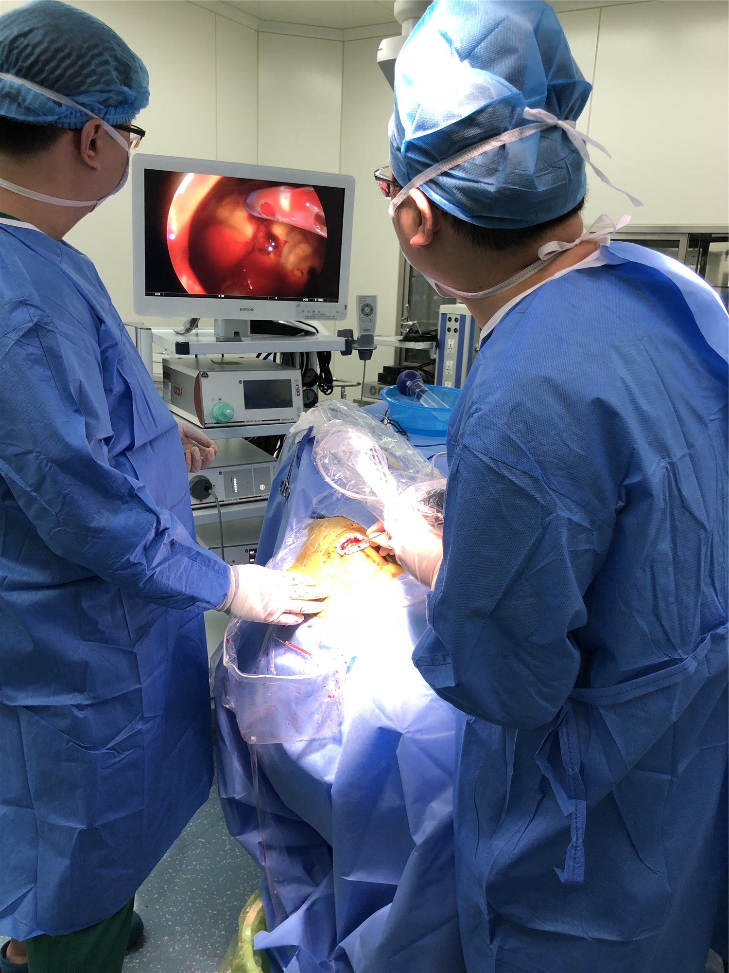 神经内镜微创技术放异彩 ——我院成功开展首例神经内镜下慢性硬膜下血肿清除