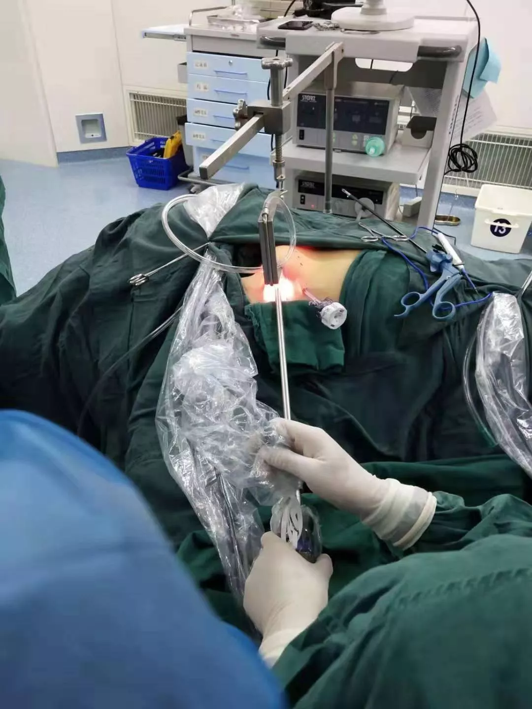 根治与美观两不误 ——我院成功开展首例“经腋路无充气腔镜下甲状腺根治术”