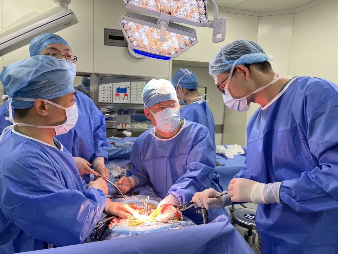 我院成功开展全肝血流阻断下复杂肝癌切除联合下腔静脉癌栓取出术