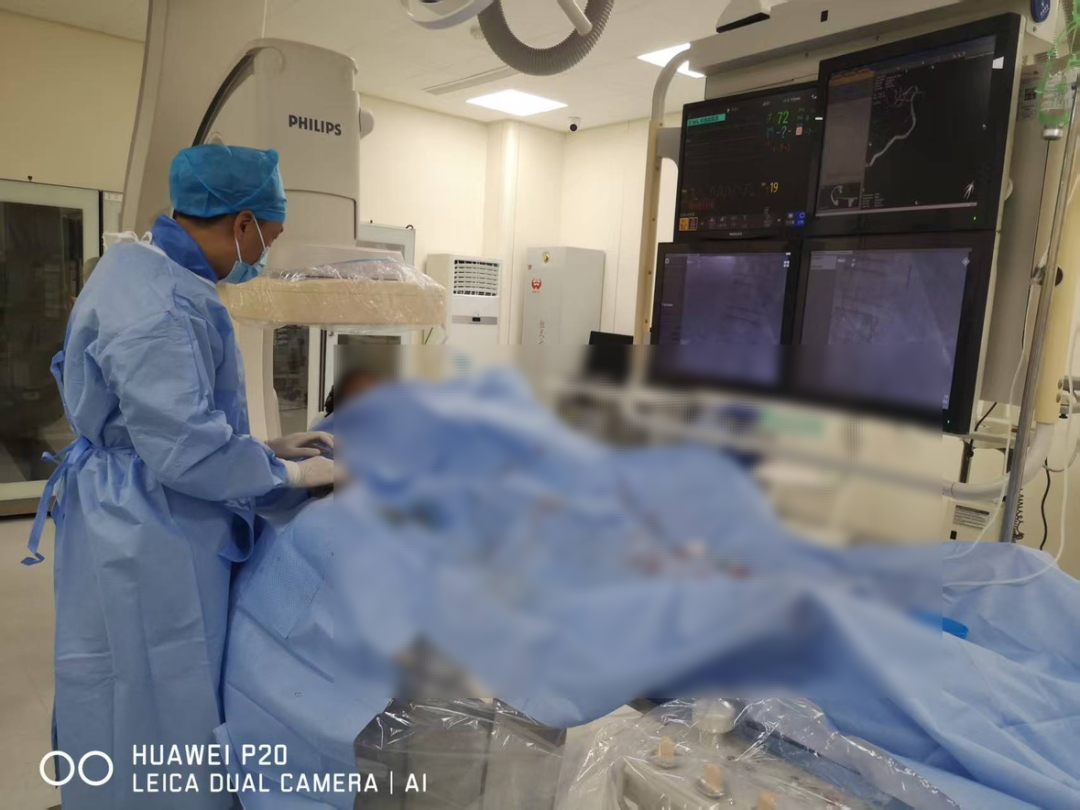 精准诊断新突破！肾上腺静脉采血助力高血压诊治