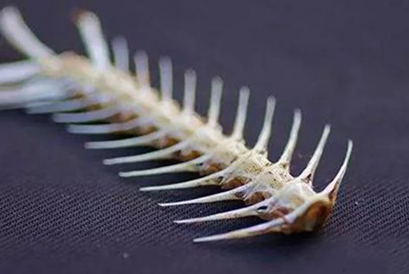 民生乐享｜鱼刺卡喉还在吞饭喝醋？医生急喊：快停手，这些“土法”太坑人！