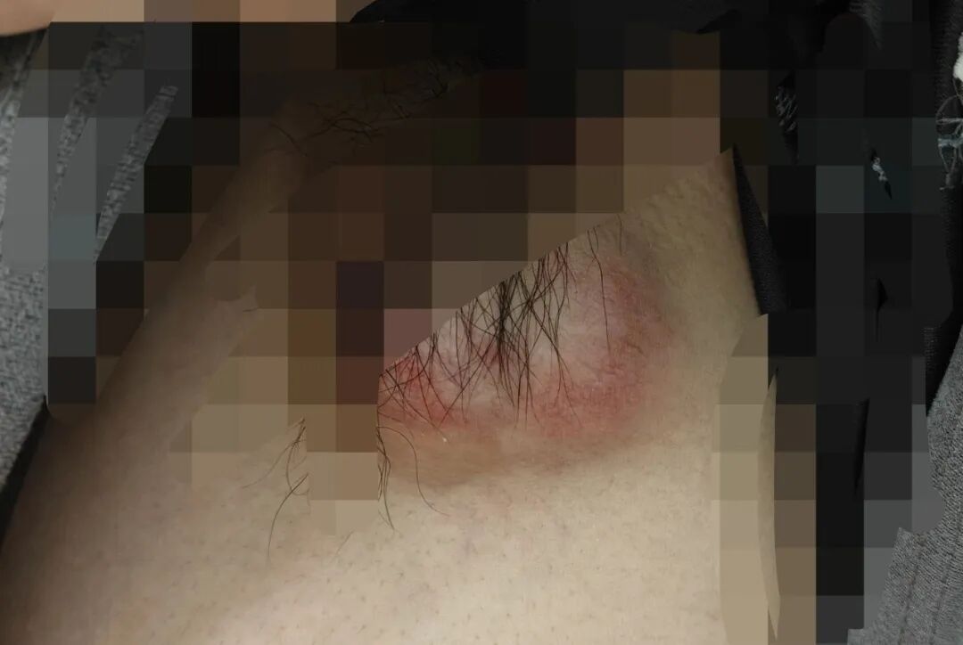 万万没想到，小伙只是撸个猫，腋下开始......