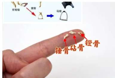 “马什么梅？马东什么？·····”耳朵里总是听不清还总是传来诡异的滋滋声 医生：要警惕这个“幕后黑手”